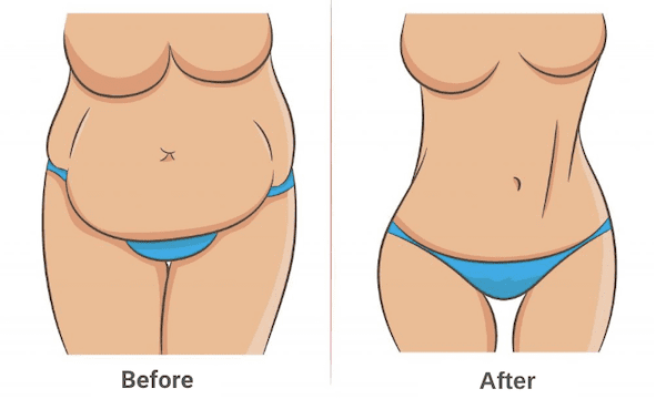 Simulation avant après