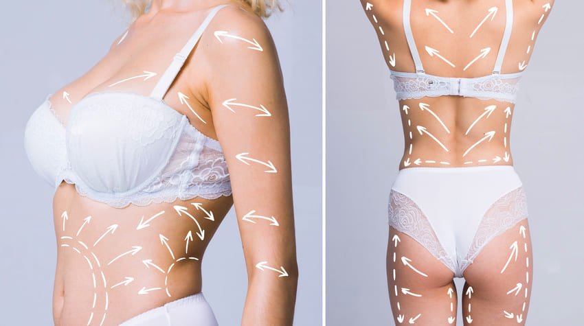 Photo de face et de dos d'un Mommy Makeover