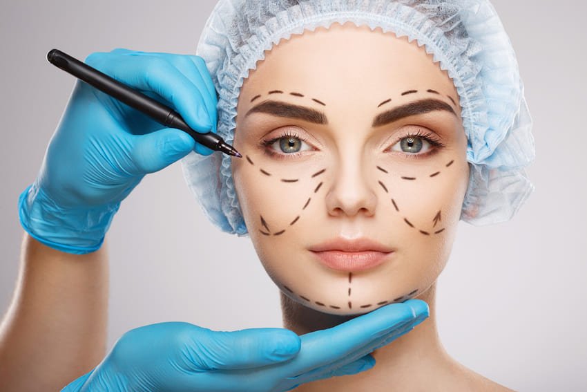 tracé d'une chirurgie faciale