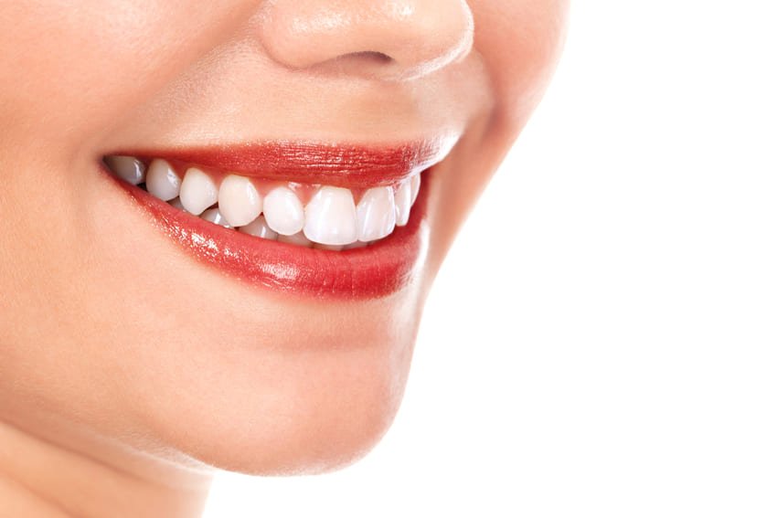 facette dentaire lumineers en Turquie